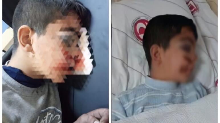 تركي يضـ ـرب طفلاً سورياً بوحشية ويكسر جمجمته في أنقرة