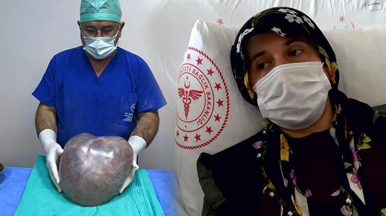 إخراج كتلة لحمية بوزن 6 كيلو من بطن امرأة تركية كانت تظن أنها حامل (صور)