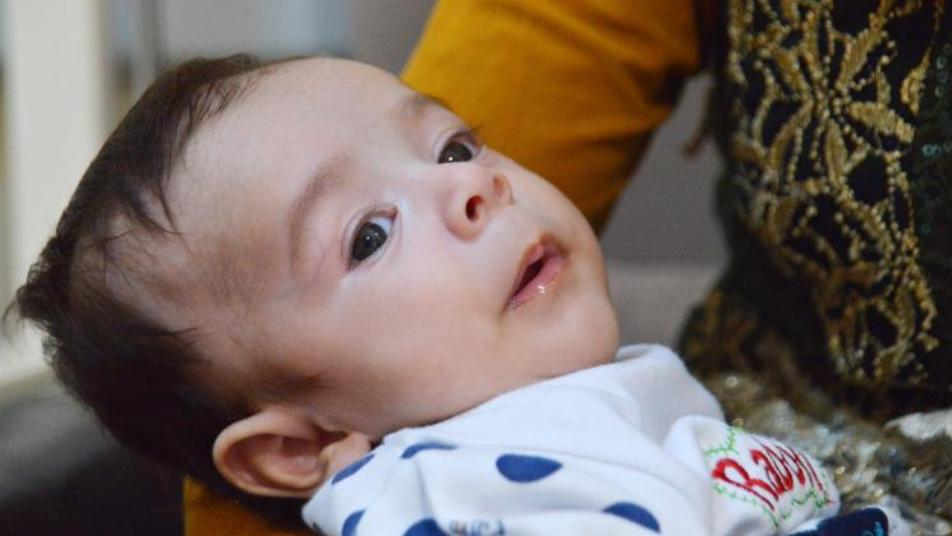 وصفوه بالطفل المعجزة.. سوري يولد وقلبه خارج صدره بمدينة أضنة التركية (صور)